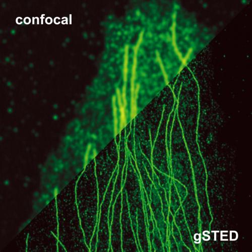 Super-resolution STED evaluation | West Campus Imaging Core